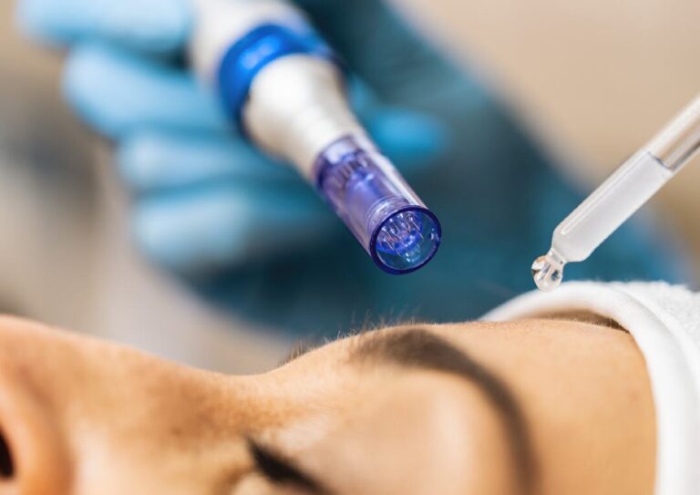 PRP and Microneedling: Advanced Skin Treatments at Westwood Clinic