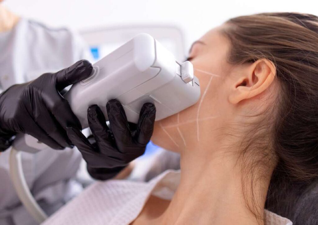 HIFU Treatment