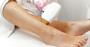 laser hair removal near me