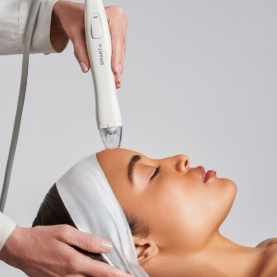 prp and zmicroneedling