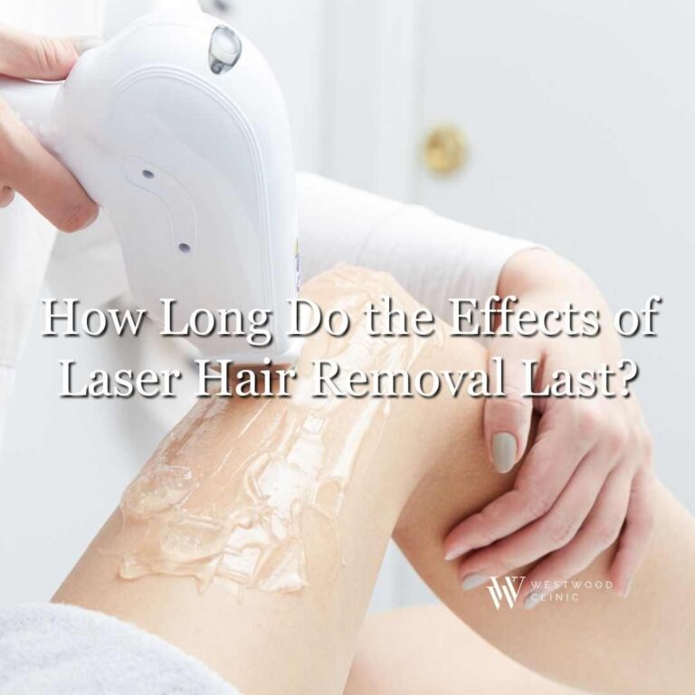 How Long Do the Effects of Laser Hair Removal Last?