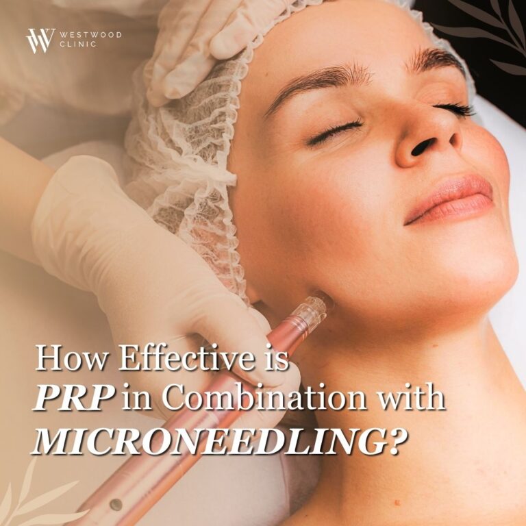How Effective is PRP in Combination with Microneedling?