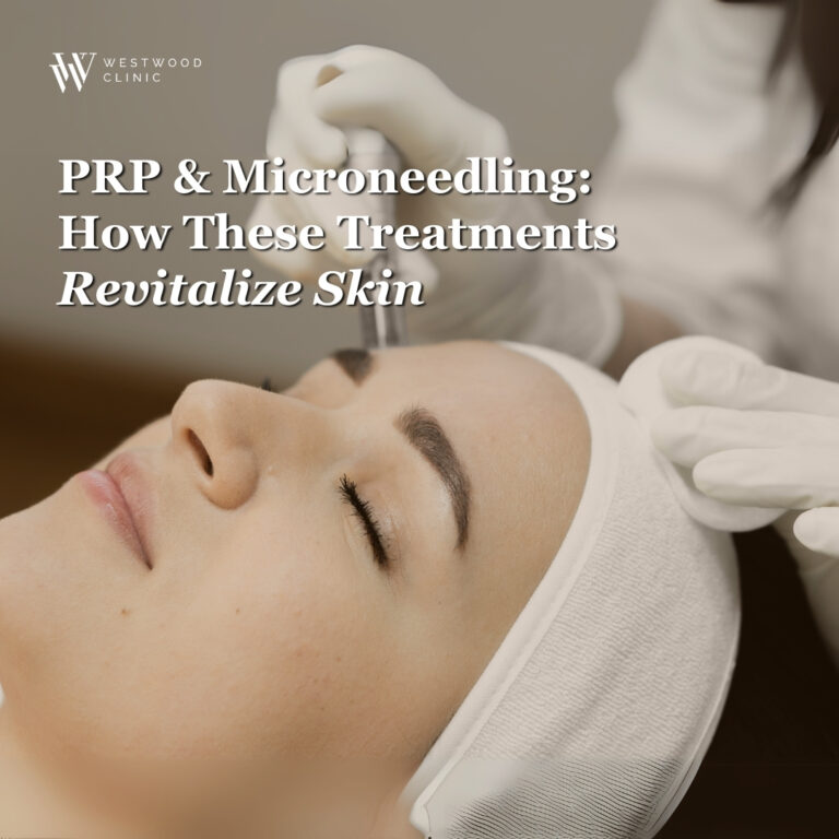 PRP and Microneedling: How These Treatments Revitalize Skin