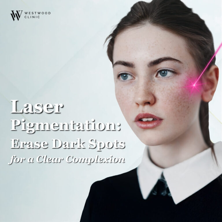 Laser Pigmentation: Erase Dark Spots for a Clear Complexion