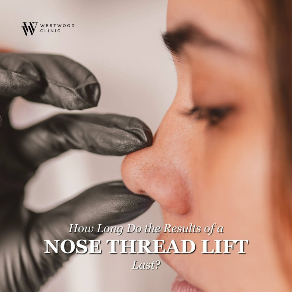 nose thread lift