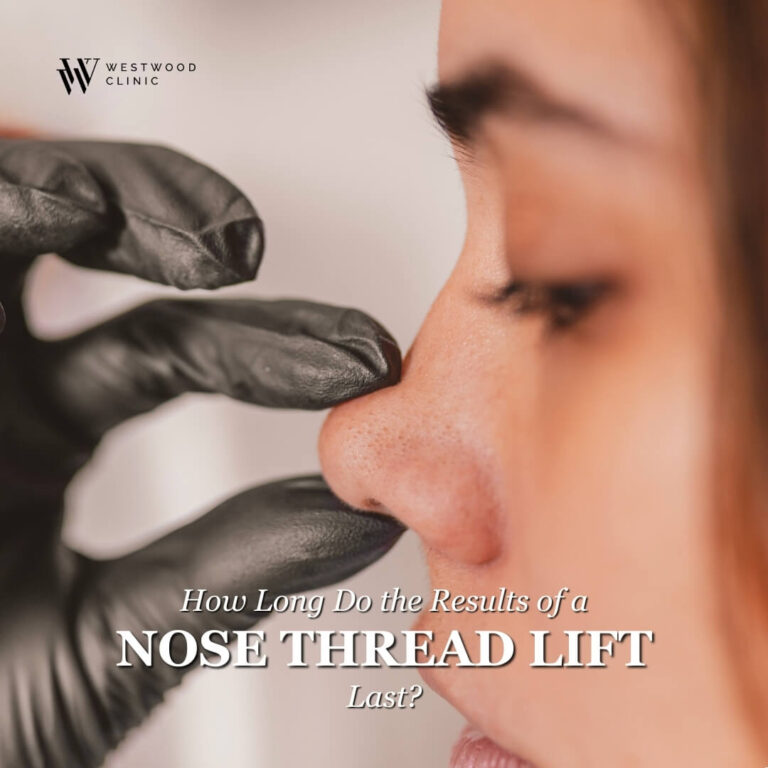 How Long Do the Results of a Nose Thread Lift Last?