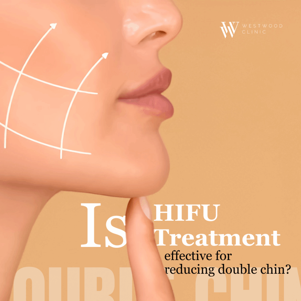 hifu treatment