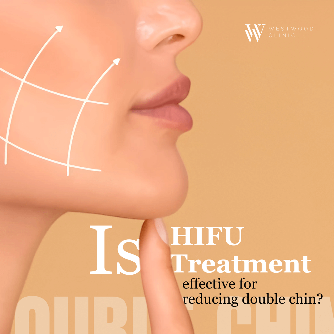 hifu treatment