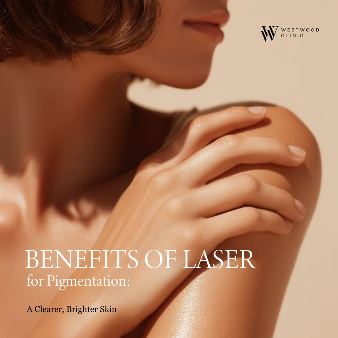 laser for pigmentation