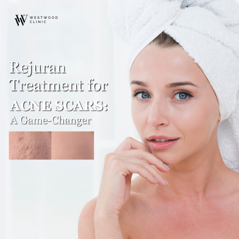 Rejuran Treatment for Acne Scars: A Game-Changer