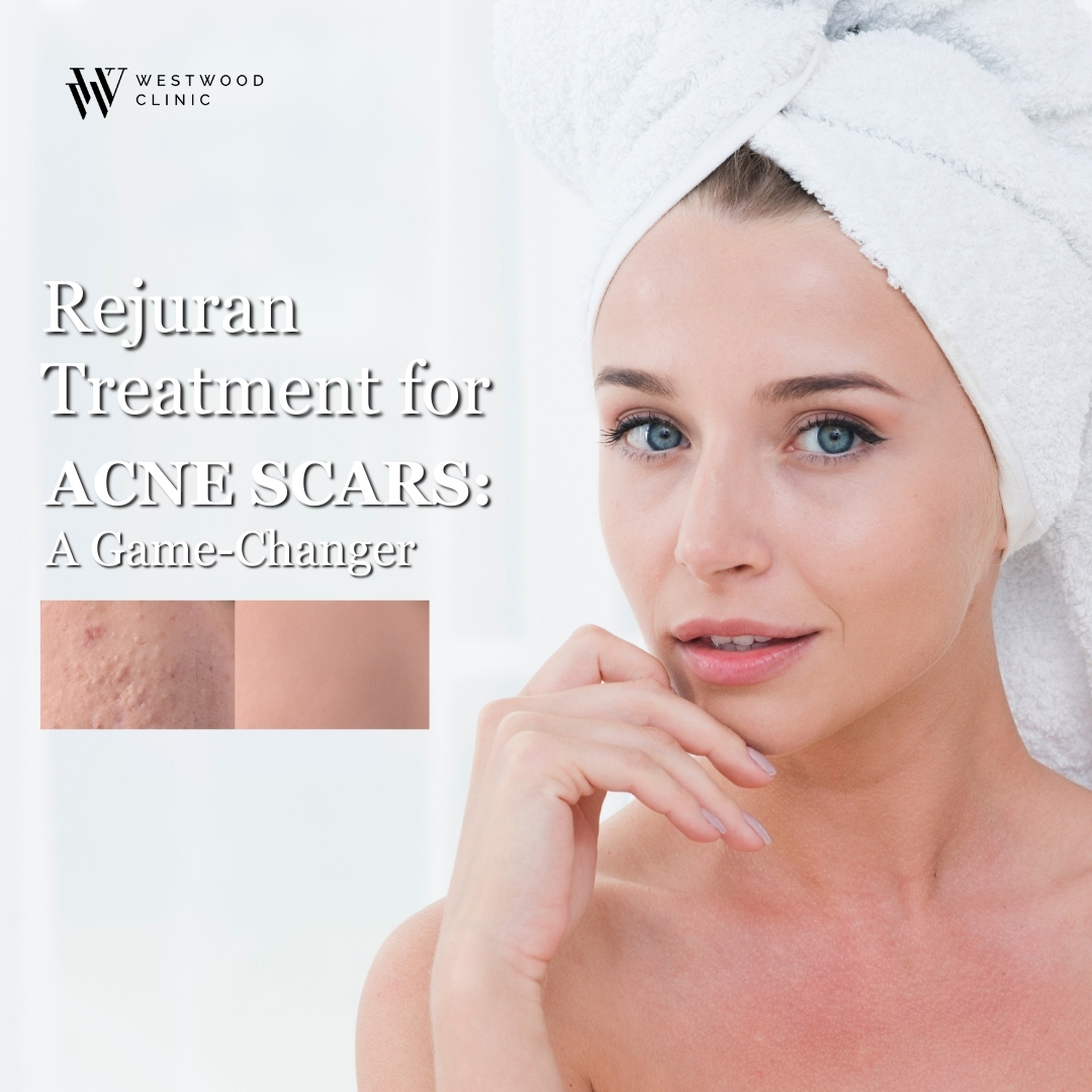 rejuran treatment