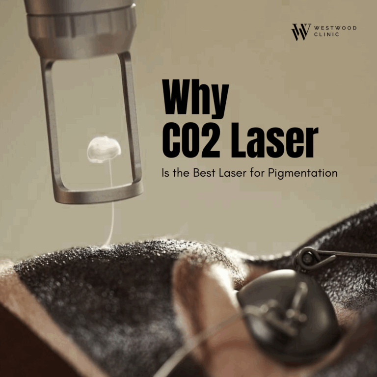 Why CO2 Laser Is the Best Laser for Pigmentation