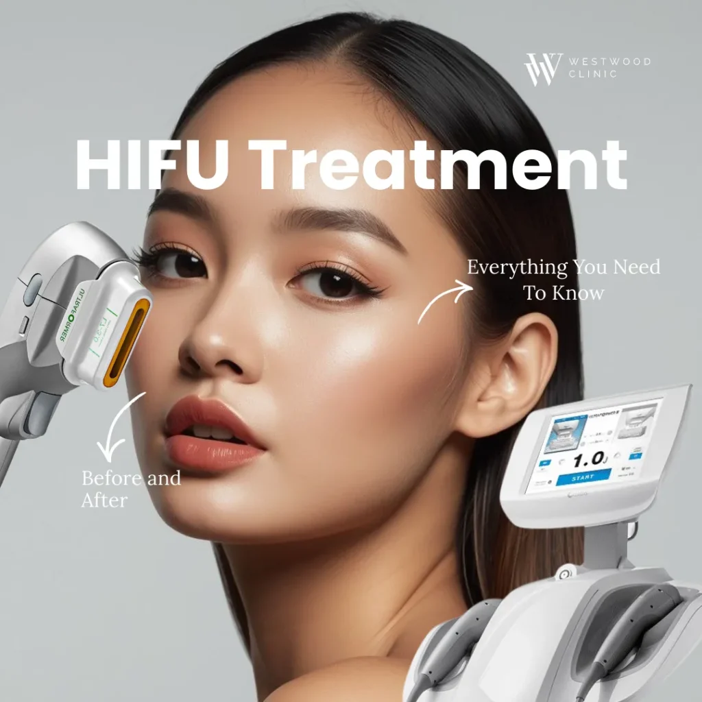 hifu treatment