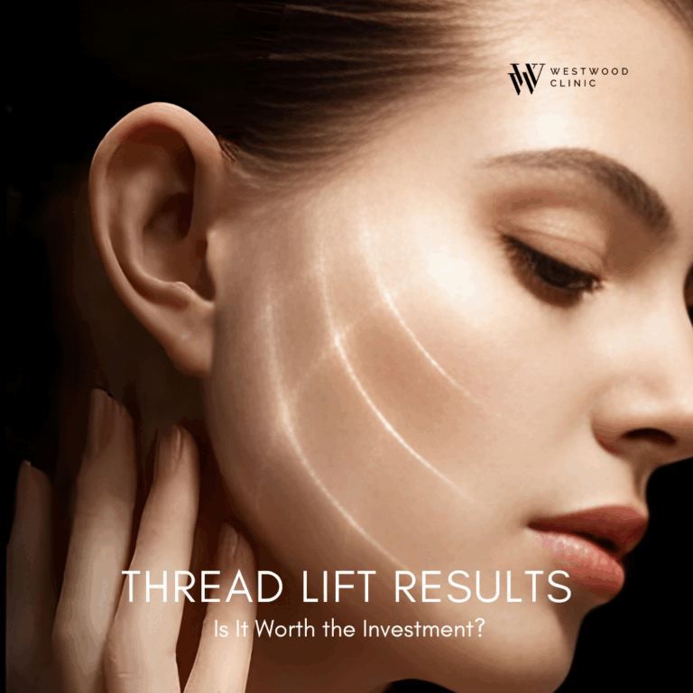 Thread Lift Results: Is It Worth the Investment?