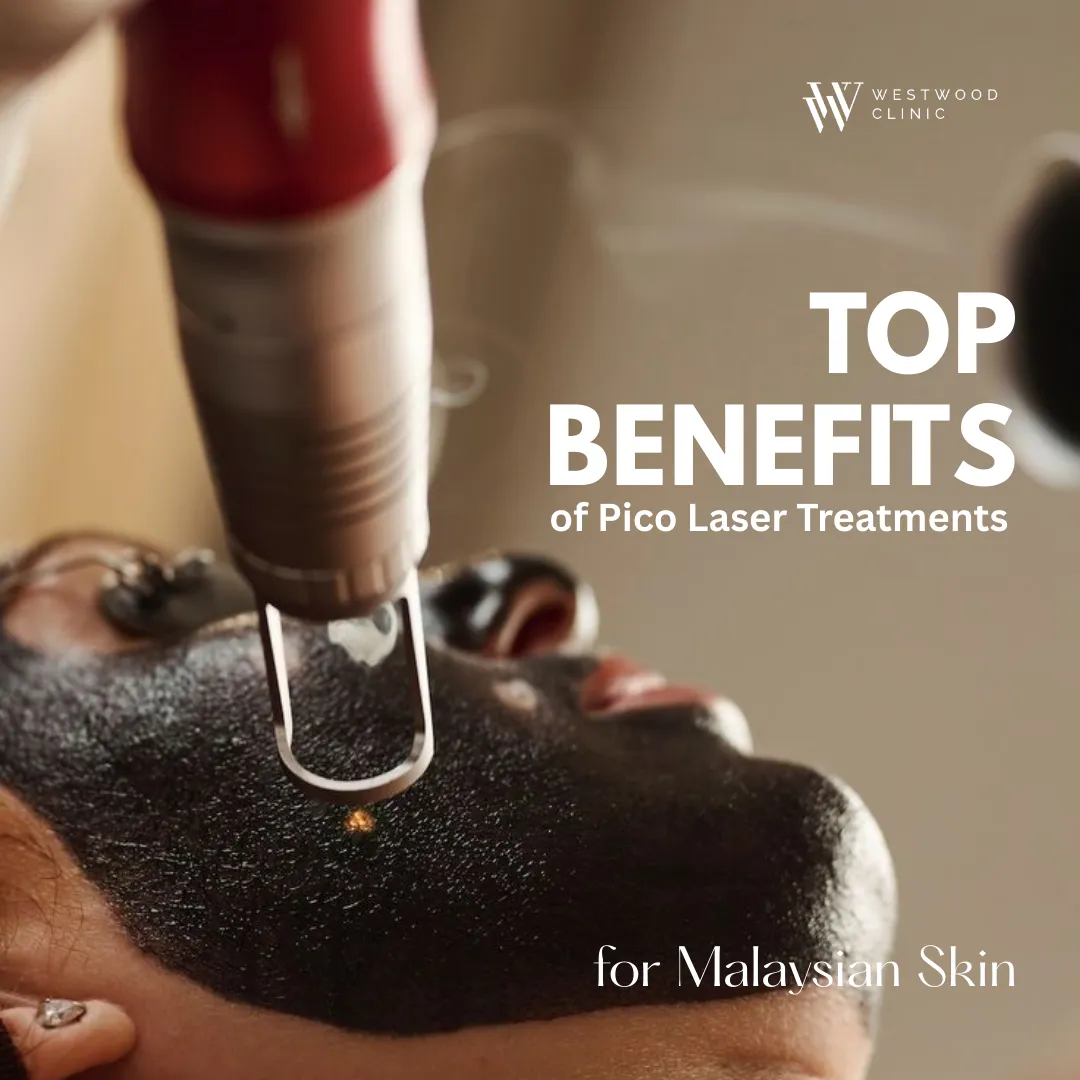 Pico laser treatment