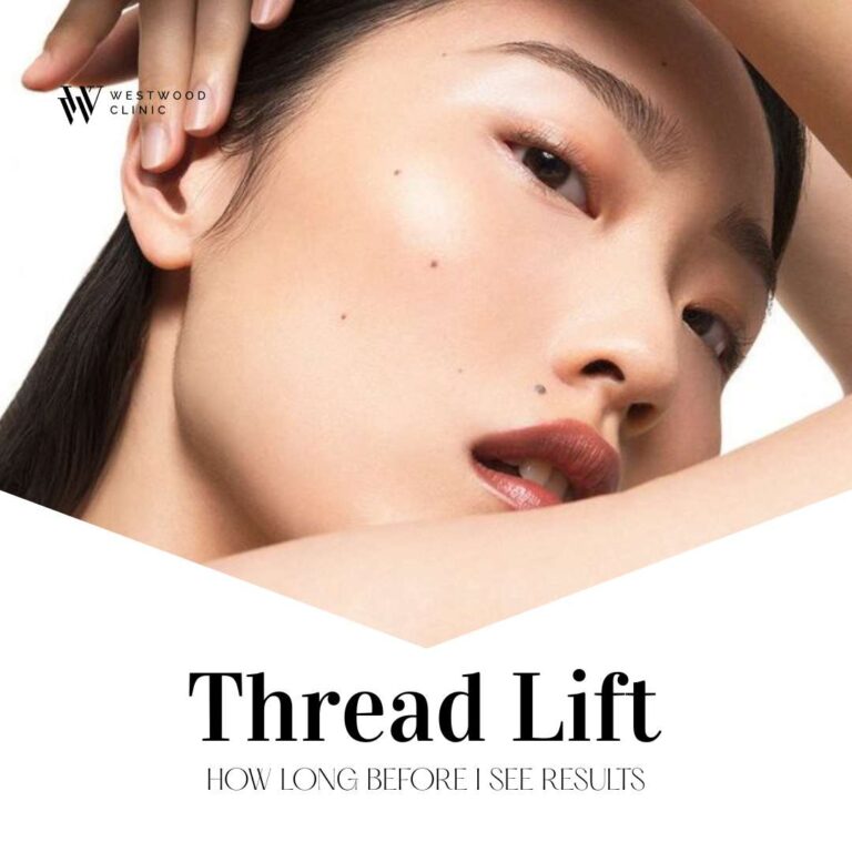 Thread Lift: How Long Before I See Results?