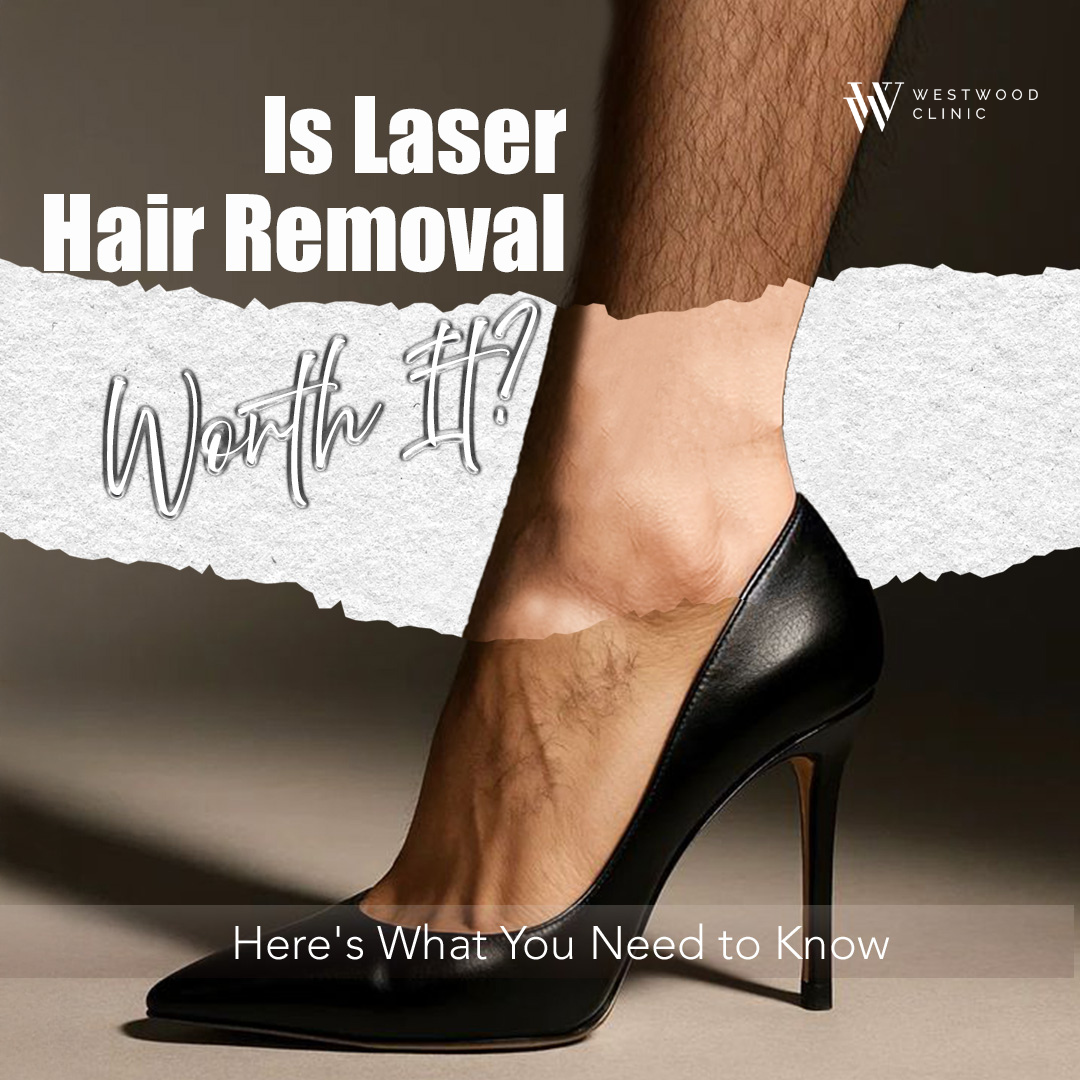 laser hair removal near me