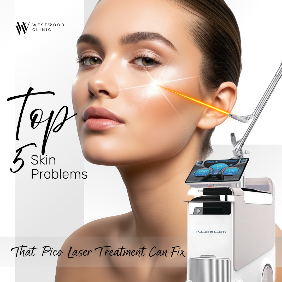 pico laser treatment
