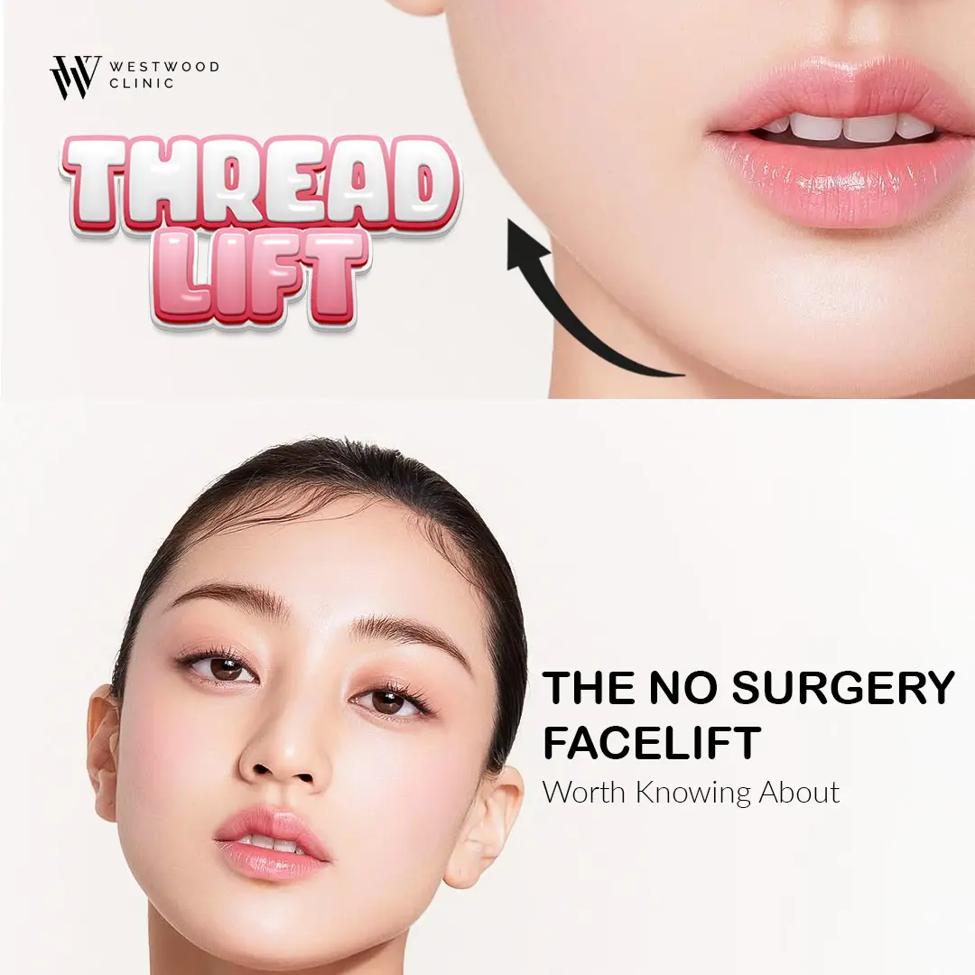 Thread Lift is the best non surgery facelift option